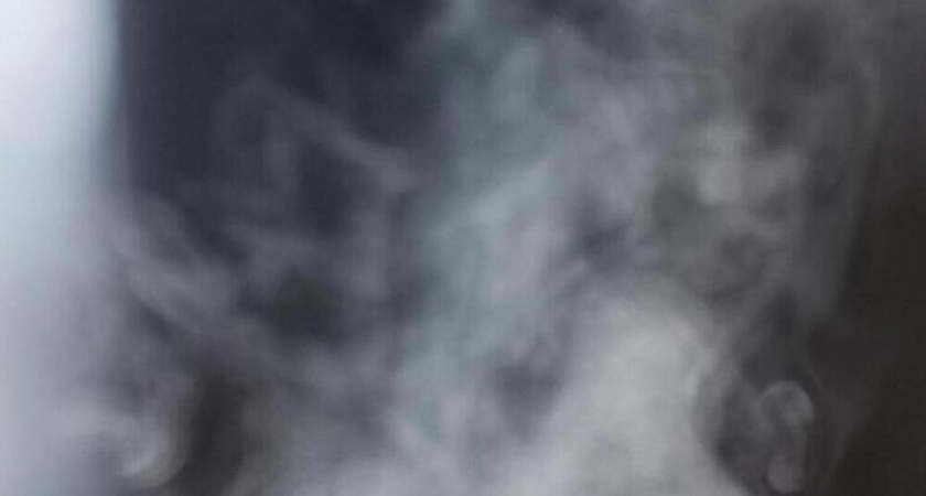 Кипяток на улице: сахалинец получил ожог ноги в затопленной яме