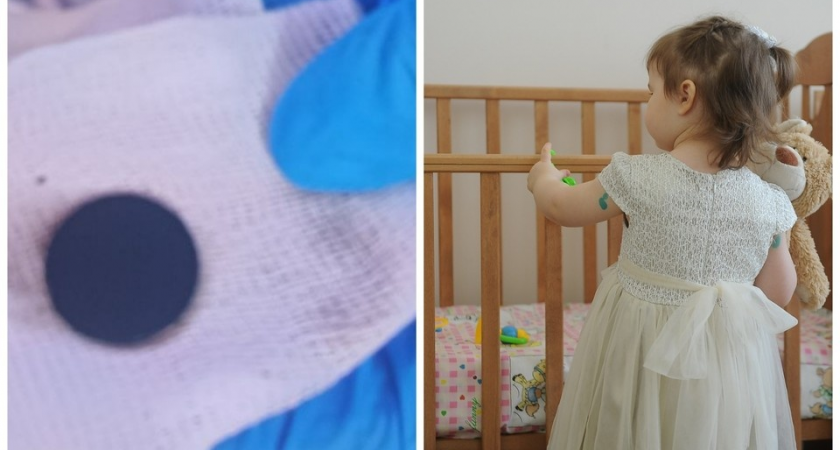 Четырехлетнюю девочку спасли дважды: порок сердца и монета в желудке