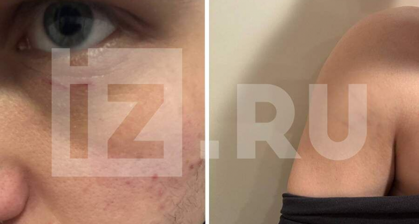 Корреспондента РЕН-ТВ повалили на землю и избили толпой силовиков в баре «МО[три]»