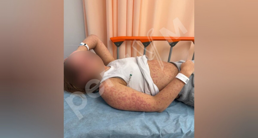 Таблетки врача чуть не убили 16-летнюю москвичку в Новый год