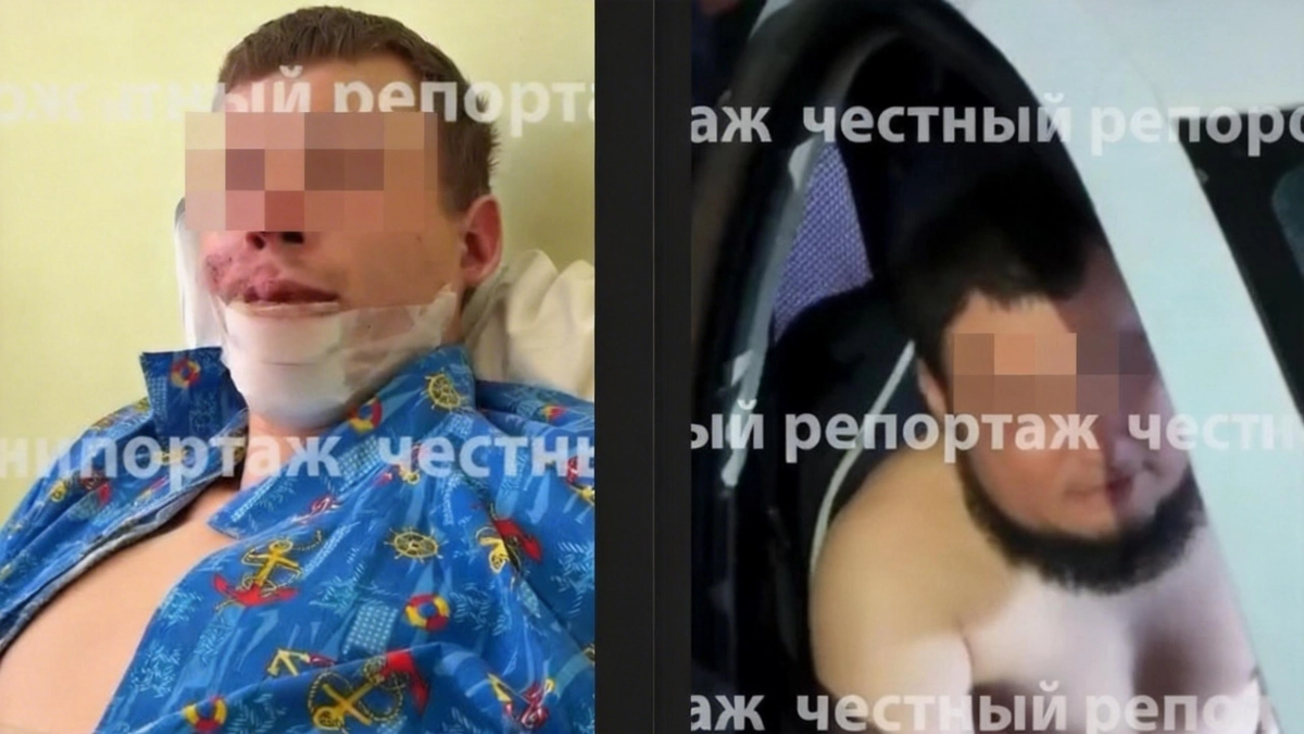 В Уфе мужчина попал в больницу с тяжёлыми травмами после замечания во дворе